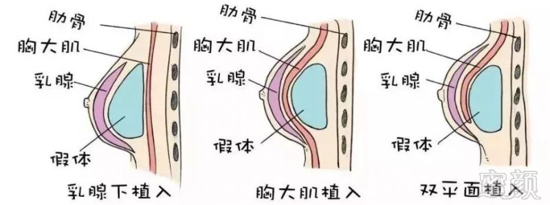 案例图片