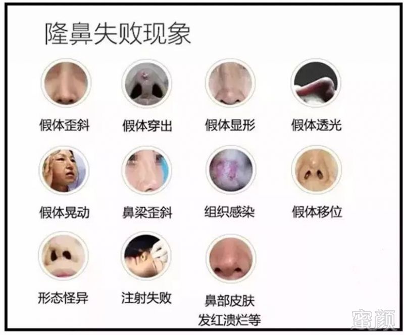 https://img.miyanlife.com/mnt/timg/190731/1235392955-0.jpg