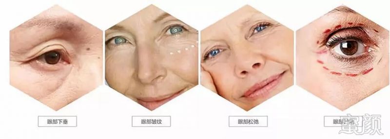 https://img.miyanlife.com/mnt/timg/190801/12105J236-8.jpg