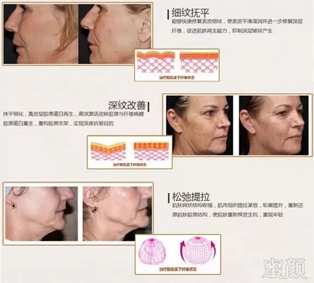 https://img.miyanlife.com/mnt/timg/190801/12105KW3-7.jpg