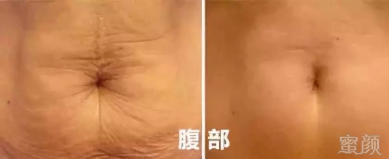 https://img.miyanlife.com/mnt/timg/190801/121100K93-9.jpg