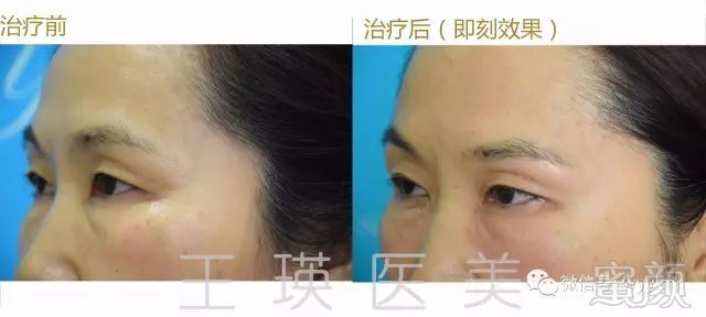 https://img.miyanlife.com/mnt/timg/190801/1211044536-13.jpg