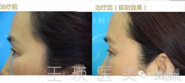 https://img.miyanlife.com/mnt/timg/190801/121105J25-14.jpg