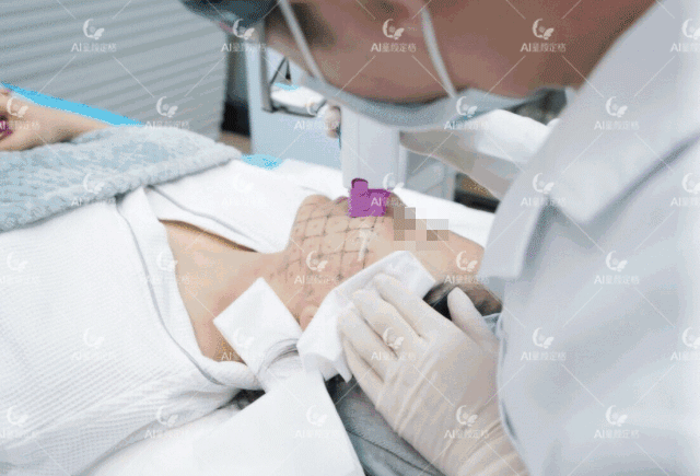 分享体验 热玛吉第5代 Ai童颜定格 蜜颜整形优惠