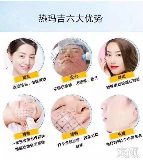 https://img.miyanlife.com/mnt/timg/190802/114330M16-3.jpg