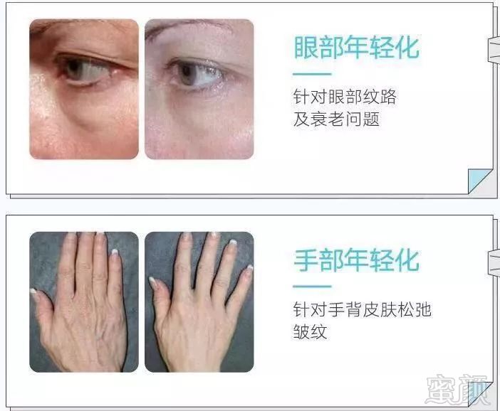 https://img.miyanlife.com/mnt/timg/190802/1143352617-7.jpg