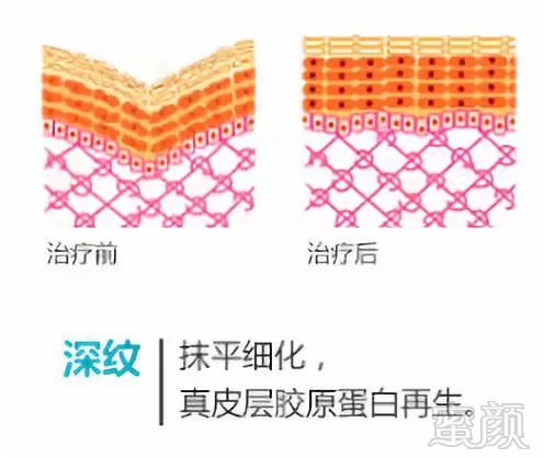 https://img.miyanlife.com/mnt/timg/190802/12351IC9-8.jpg