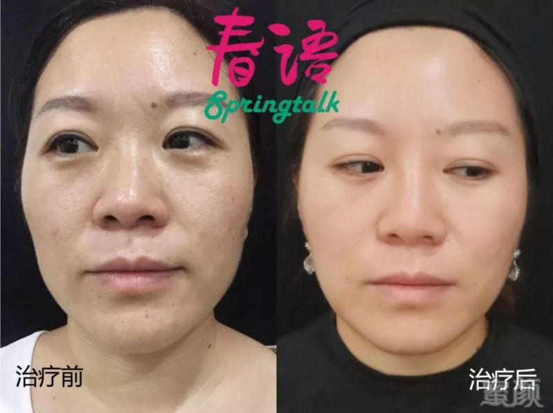 https://img.miyanlife.com/mnt/timg/190802/12351Q452-10.jpg