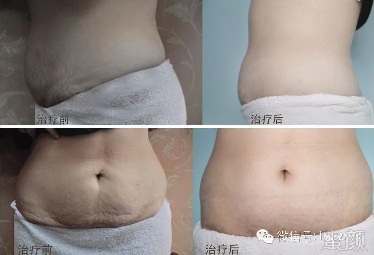 https://img.miyanlife.com/mnt/timg/190802/12360W109-5.jpg