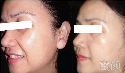 https://img.miyanlife.com/mnt/timg/190802/123613J07-7.jpg