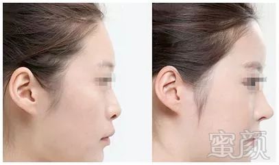 https://img.miyanlife.com/mnt/timg/190802/12493135Q-5.jpg
