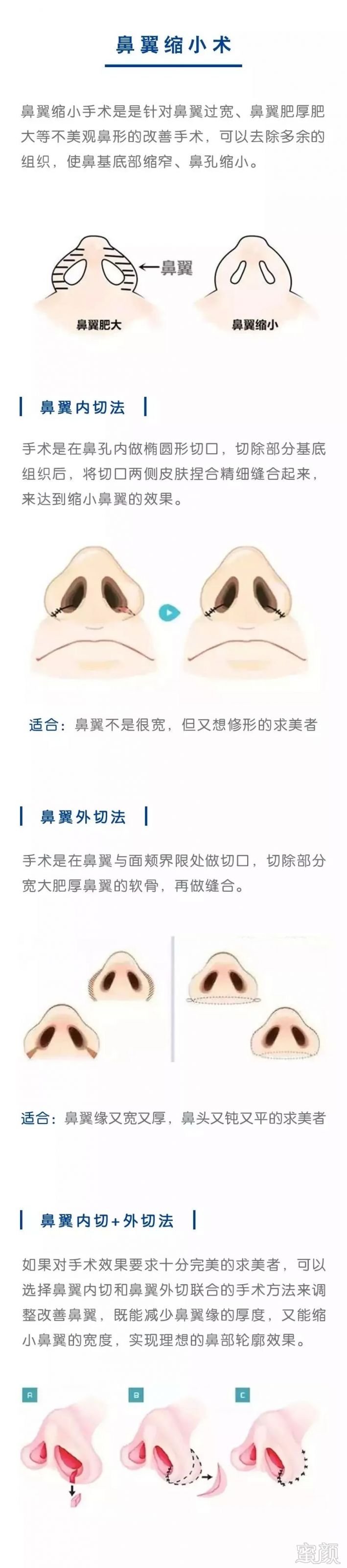 https://img.miyanlife.com/mnt/timg/190802/125A51308-4.jpg