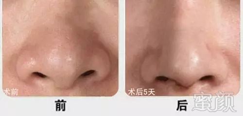 https://img.miyanlife.com/mnt/timg/190802/125AJY9-5.jpg
