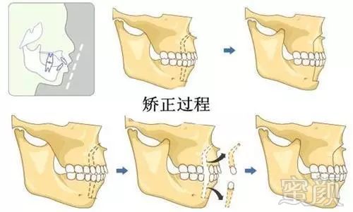 案例图片