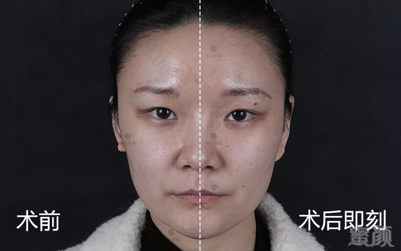 https://img.miyanlife.com/mnt/timg/190803/1135151044-15.jpg