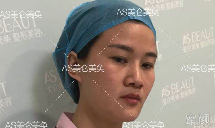 https://img.miyanlife.com/mnt/timg/190803/114K341U-4.jpg