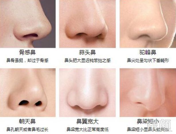 https://img.miyanlife.com/mnt/timg/190803/114KCH3-10.jpg