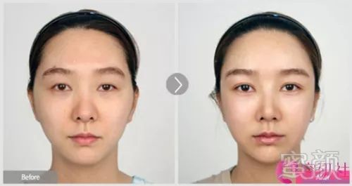 https://img.miyanlife.com/mnt/timg/190804/122R63023-7.jpg