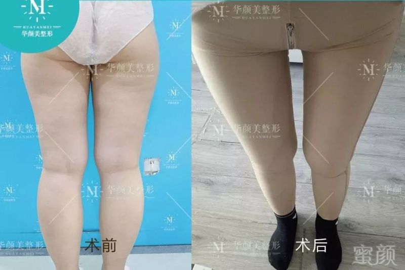 https://img.miyanlife.com/mnt/timg/190804/12331V4G-1.jpg