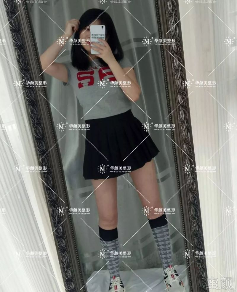 https://img.miyanlife.com/mnt/timg/190804/12332LV2-7.jpg