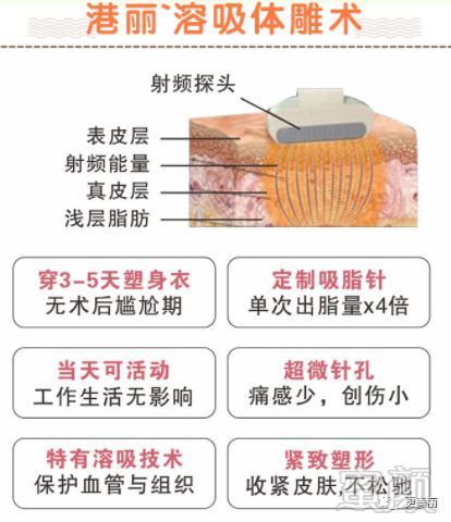 https://img.miyanlife.com/mnt/timg/190804/12432LS7-6.jpg