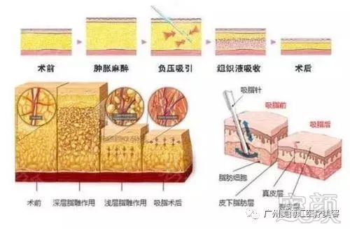 https://img.miyanlife.com/mnt/timg/190804/12453L155-5.jpg