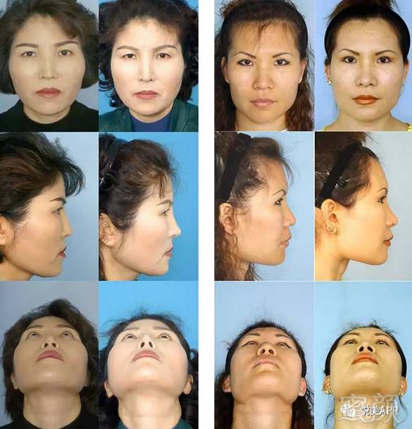 https://img.miyanlife.com/mnt/timg/190804/13191222V-7.jpg