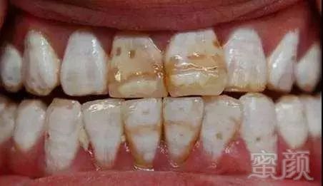 https://img.miyanlife.com/mnt/timg/190805/11043RS9-3.jpg