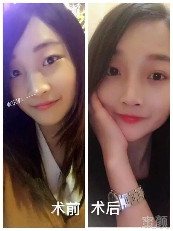 https://img.miyanlife.com/mnt/timg/190805/1135002O2-8.jpg