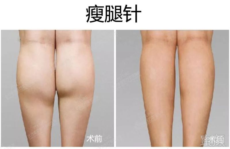 https://img.miyanlife.com/mnt/timg/190805/1135512T4-3.jpg