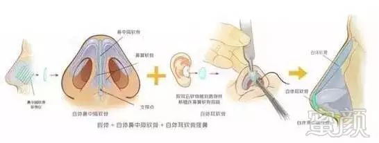 https://img.miyanlife.com/mnt/timg/190805/11455W232-4.jpg