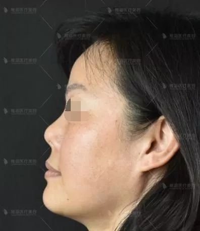 https://img.miyanlife.com/mnt/timg/190805/1146343022-1.jpg