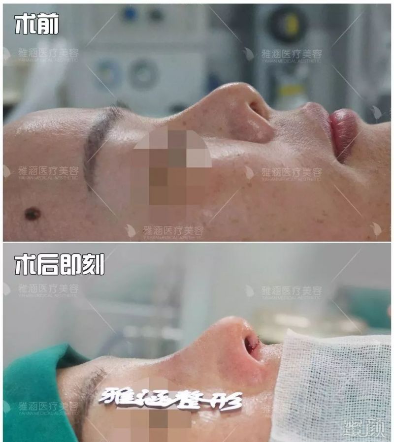 https://img.miyanlife.com/mnt/timg/190805/11463A3D-3.jpg
