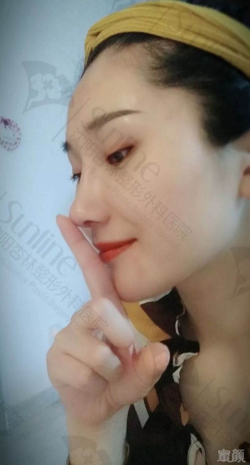 https://img.miyanlife.com/mnt/timg/190805/1159463P5-7.jpg