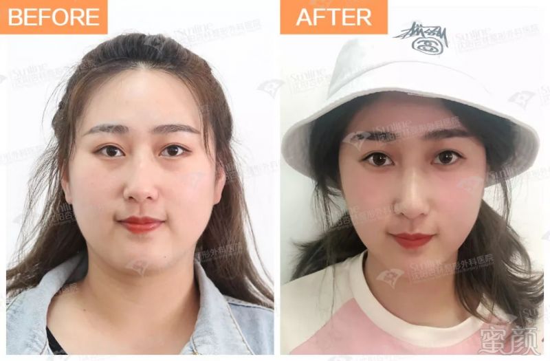 https://img.miyanlife.com/mnt/timg/190805/1159504G3-13.jpg