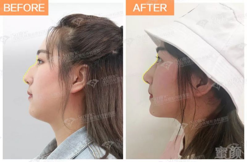 https://img.miyanlife.com/mnt/timg/190805/115951JE-15.jpg