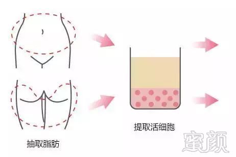 https://img.miyanlife.com/mnt/timg/190806/11231641O-3.jpg