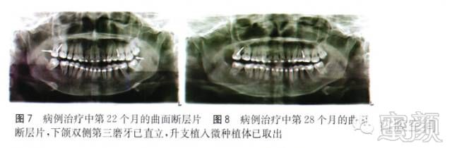 案例图片