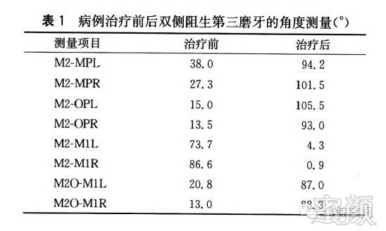 案例图片