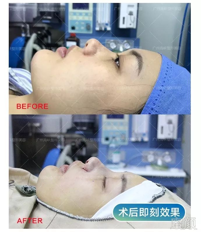 https://img.miyanlife.com/mnt/timg/190807/1135315122-4.jpg