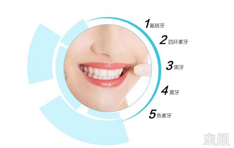 https://img.miyanlife.com/mnt/timg/190807/11531G4F-3.jpg