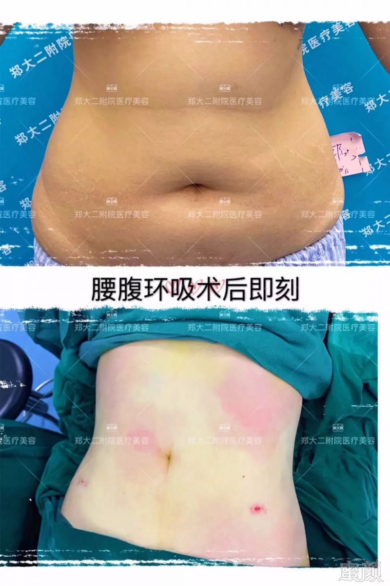 https://img.miyanlife.com/mnt/timg/190807/120444I51-1.jpg