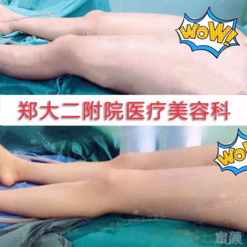 https://img.miyanlife.com/mnt/timg/190807/12044R959-7.jpg