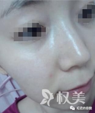 https://img.miyanlife.com/mnt/timg/190807/121KL5D-2.jpg
