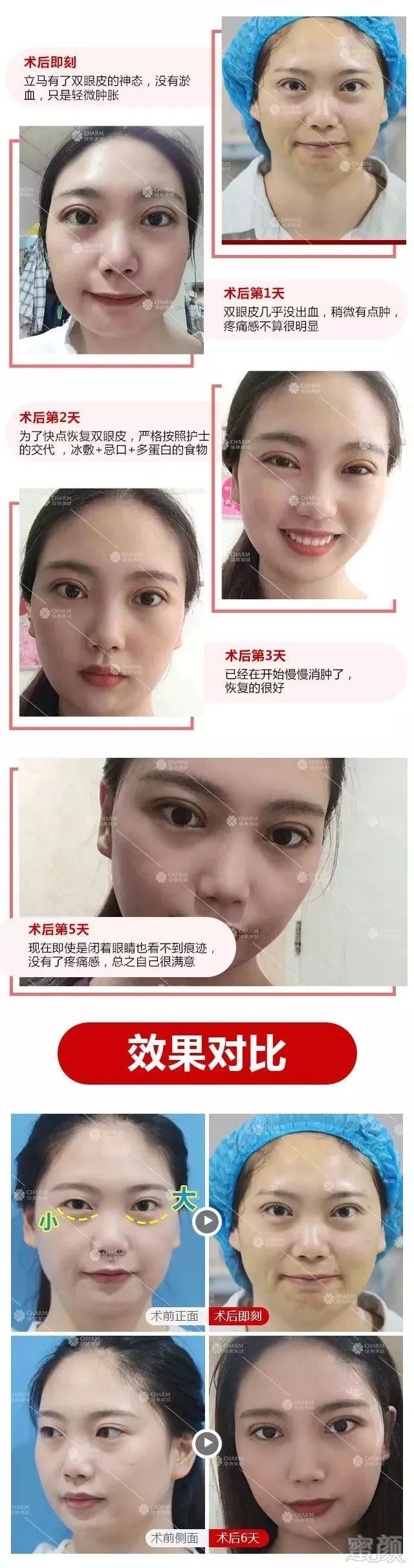 案例图片