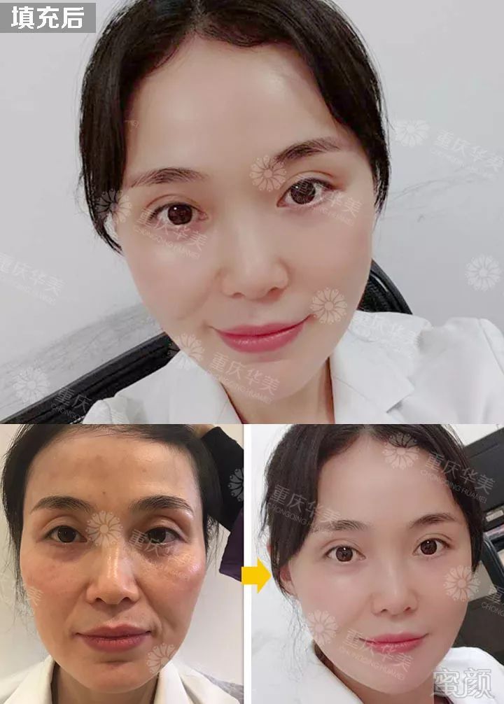 https://img.miyanlife.com/mnt/timg/190809/11504C2C-6.jpg