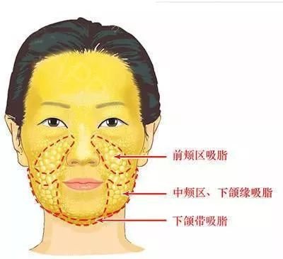 https://img.miyanlife.com/mnt/timg/190809/1150502095-13.jpg