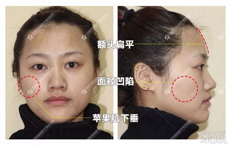 https://img.miyanlife.com/mnt/timg/190809/123Z11096-7.jpg