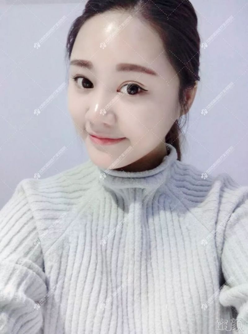 https://img.miyanlife.com/mnt/timg/190809/123Z3H59-9.jpg