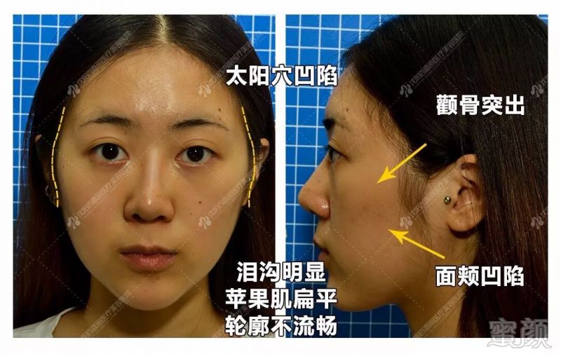 https://img.miyanlife.com/mnt/timg/190809/123Z430N-10.jpg